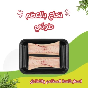 الصفحة الرائسية Bone Marrow